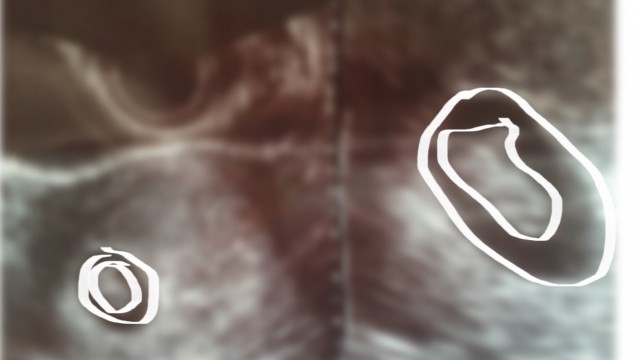 妊婦健診（7w4d）胎芽が確認できた！予定日はいつ？